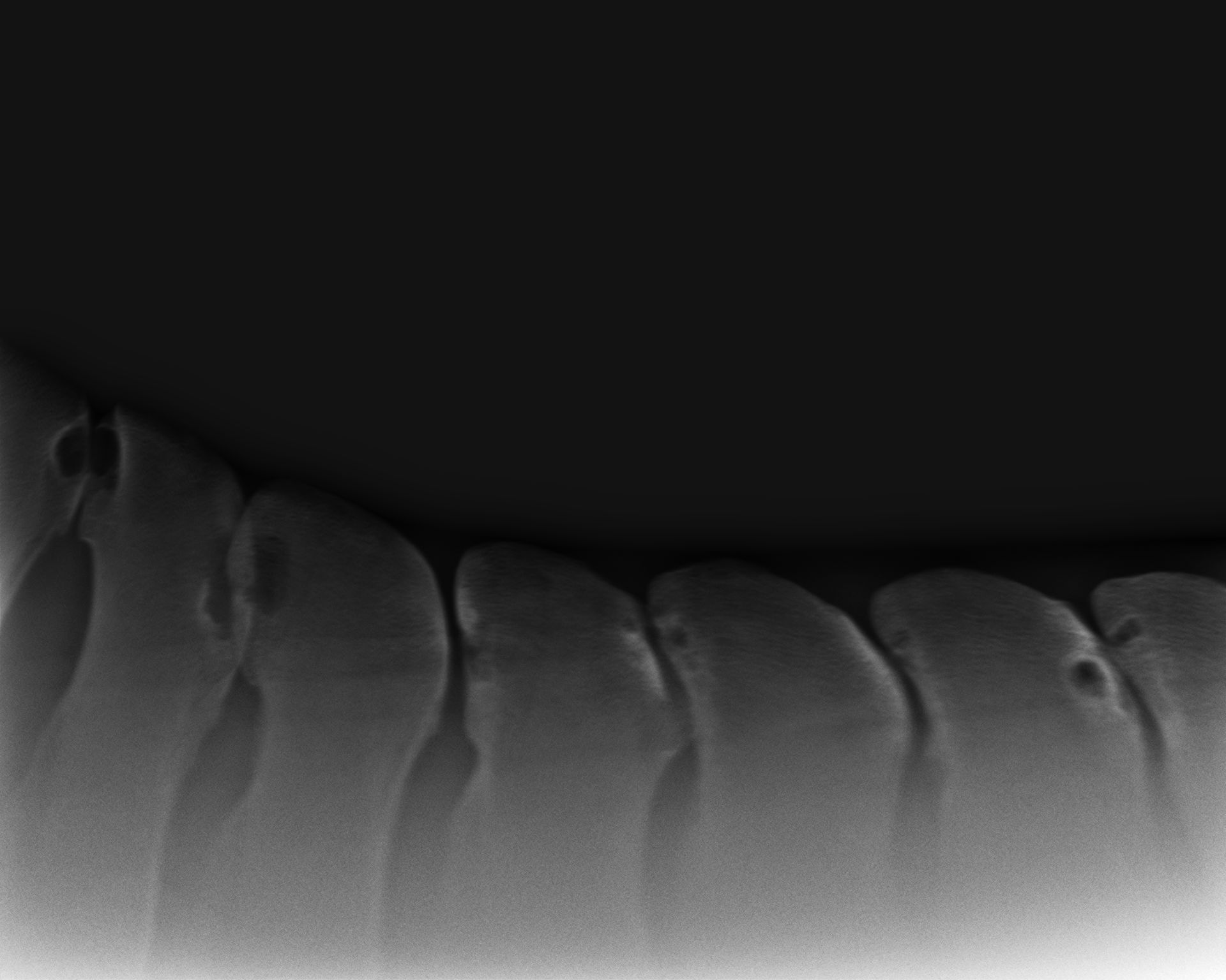 Read more about the article Thorny process conflicts in the horse: recognizing and accompanying kissing spines